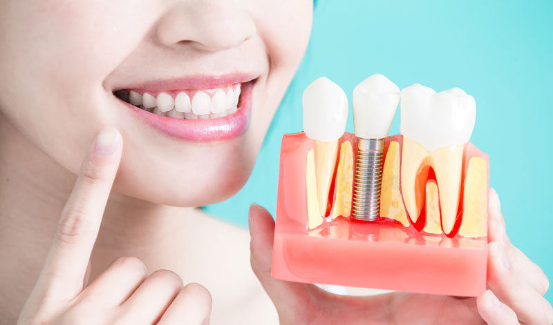 Dental Implant Treatment at Mornington Peninsula